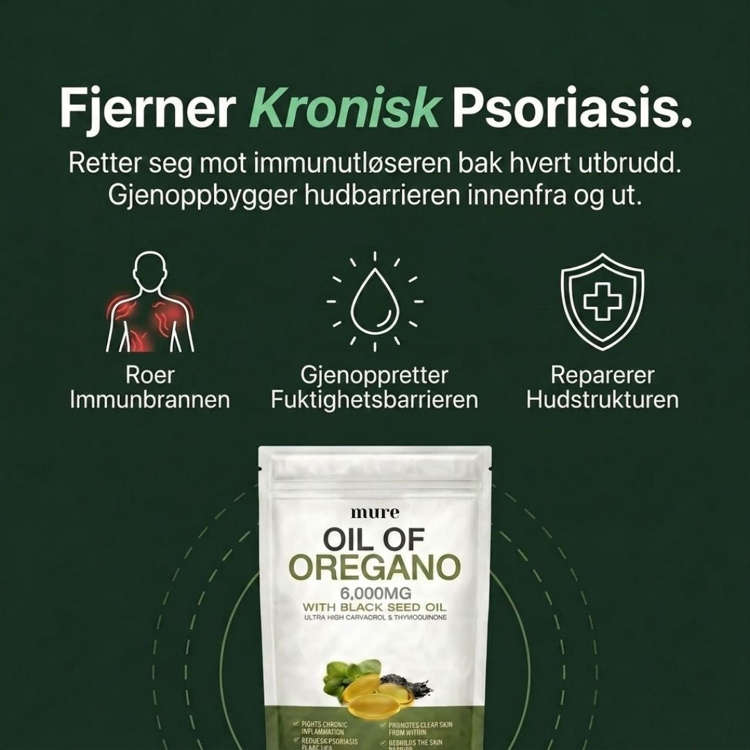 OREGANO & SVARTFRØOLJE – HJELPER MOT PSORIASIS INNENFRA OG UT