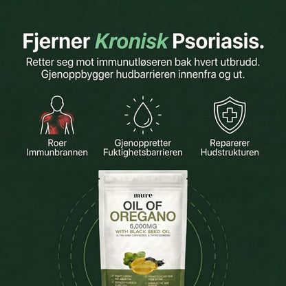 OREGANO & SVARTFRØOLJE – HJELPER MOT PSORIASIS INNENFRA OG UT
