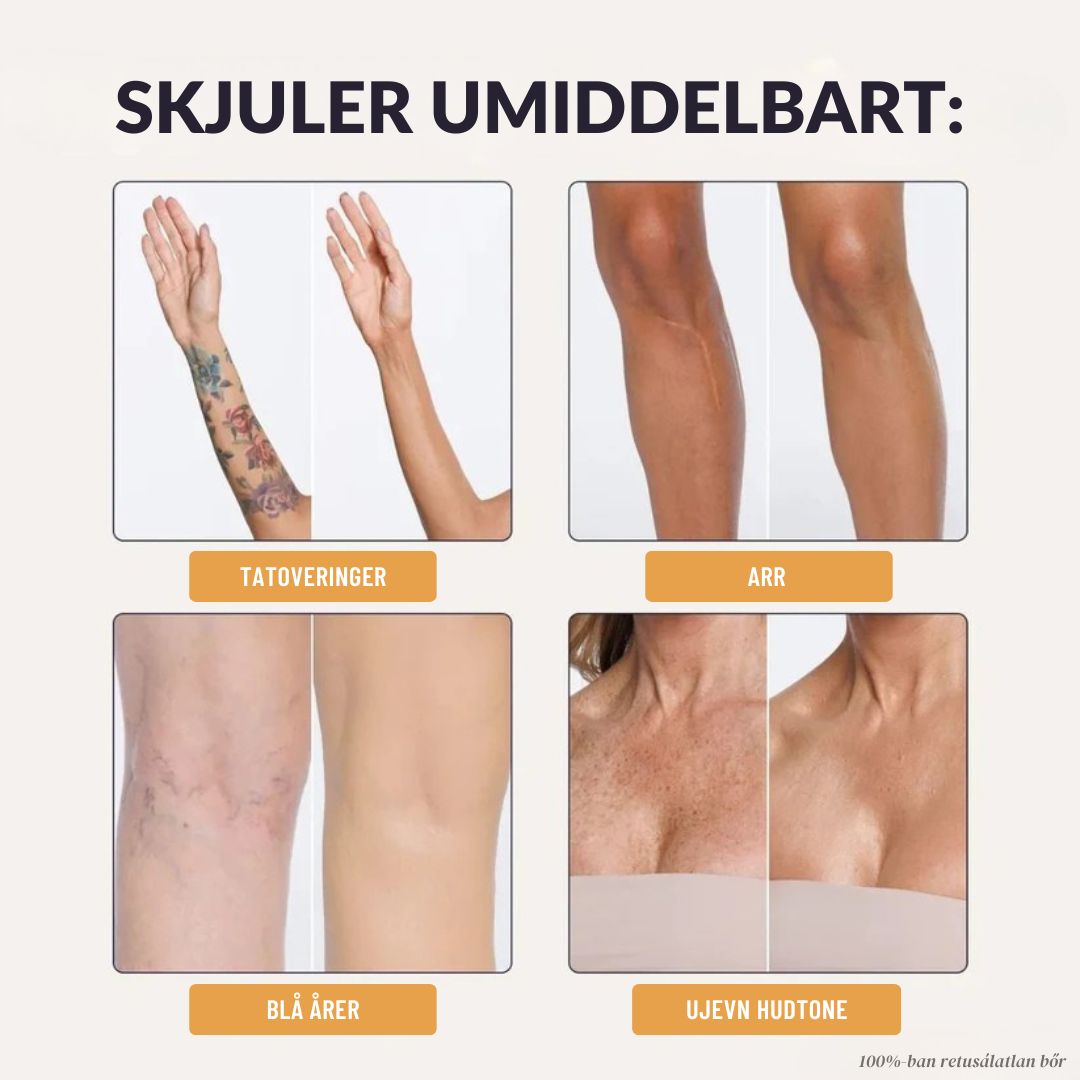 Mure Øyeblikkelig Kroppsdekke