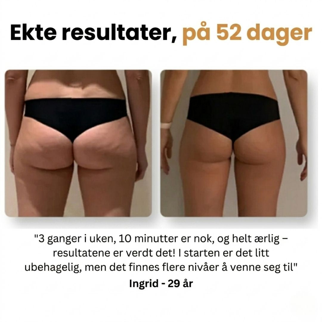 Mure Anti-cellulitt massasjeapparat
