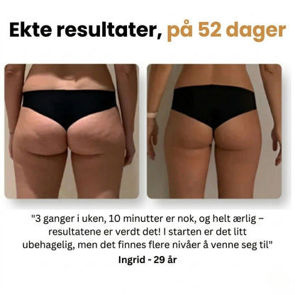Mure Anti-cellulitt massasjeapparat
