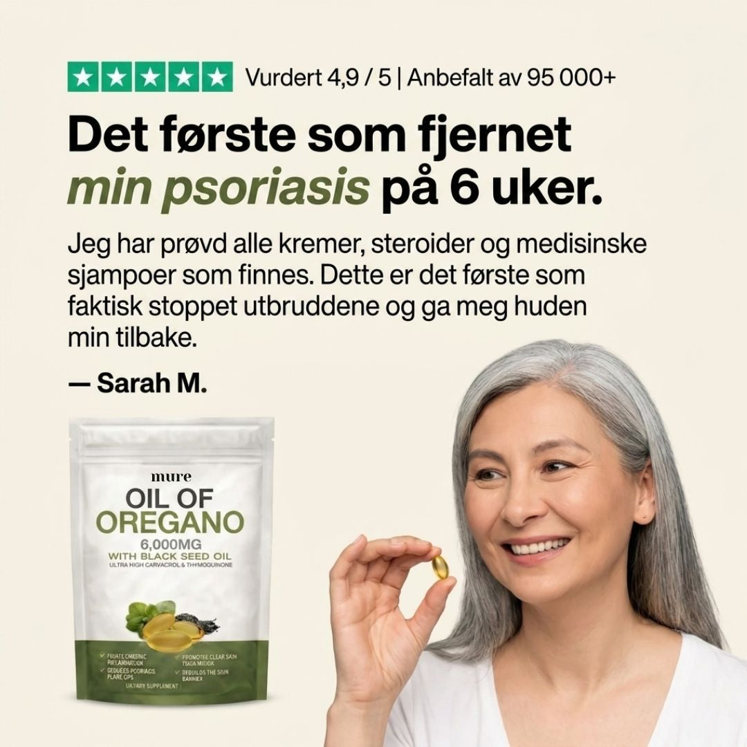 OREGANO & SVARTFRØOLJE – HJELPER MOT PSORIASIS INNENFRA OG UT