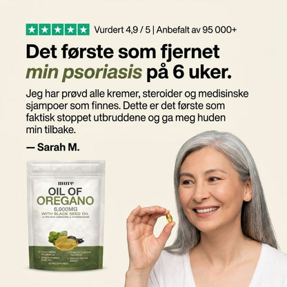 OREGANO & SVARTFRØOLJE – HJELPER MOT PSORIASIS INNENFRA OG UT