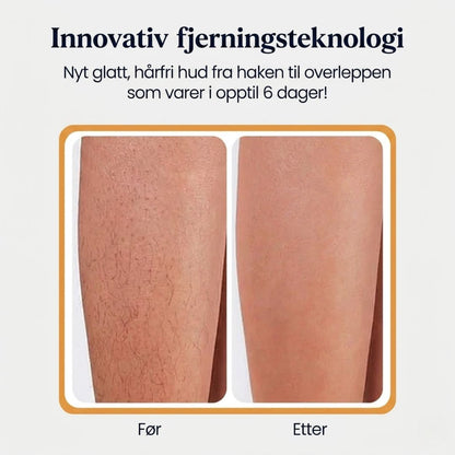 Smertefri hårfjerningskrem
