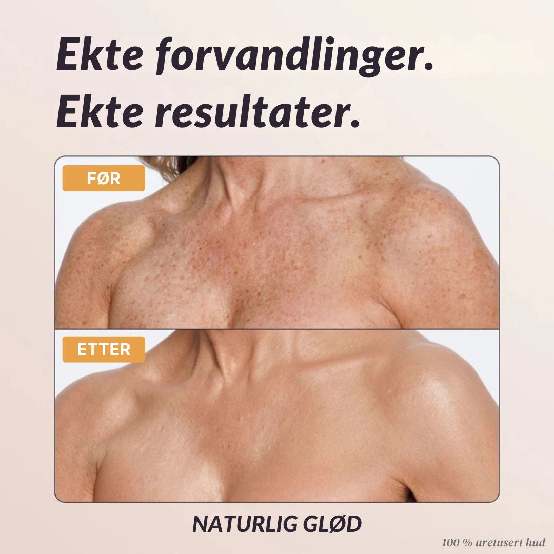 Mure Øyeblikkelig Kroppsdekke