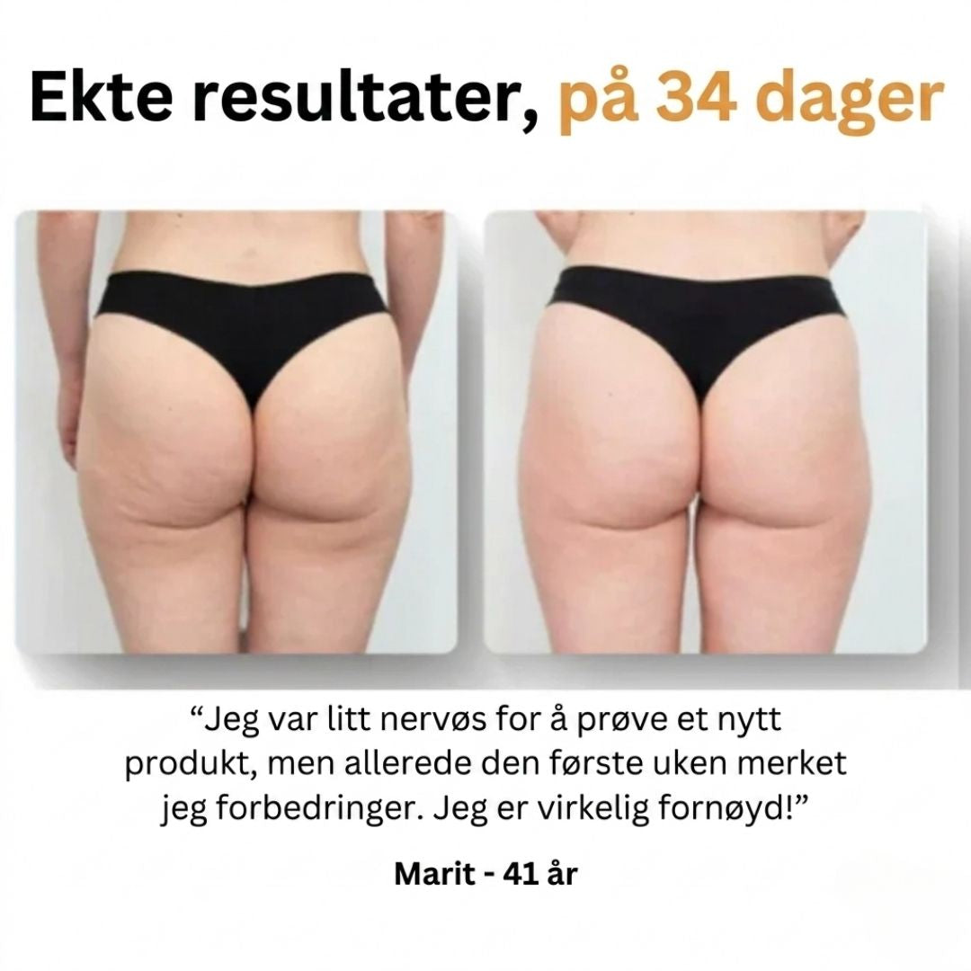 Mure Anti-cellulitt massasjeapparat