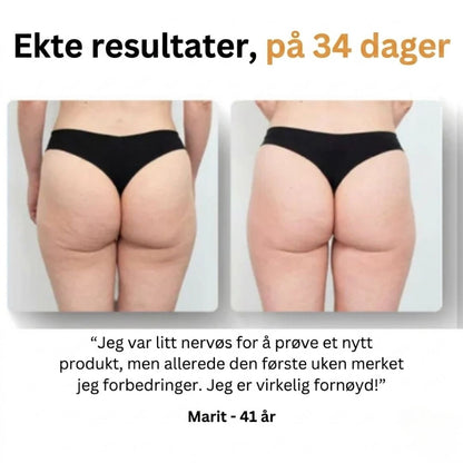 Mure Anti-cellulitt massasjeapparat