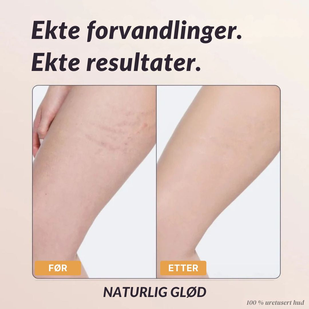 Mure Øyeblikkelig Kroppsdekke