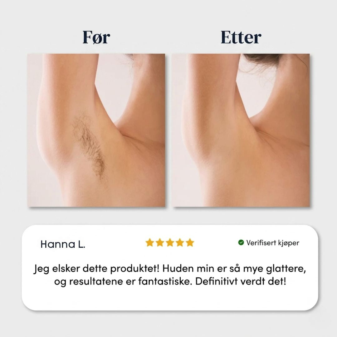 Smertefri hårfjerningskrem