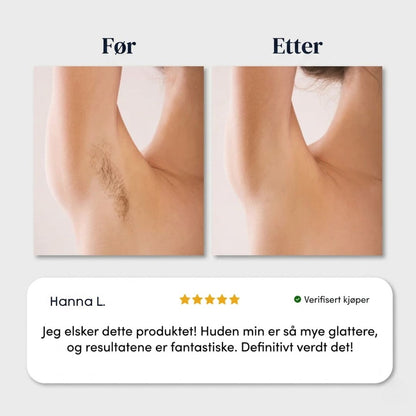 Smertefri hårfjerningskrem